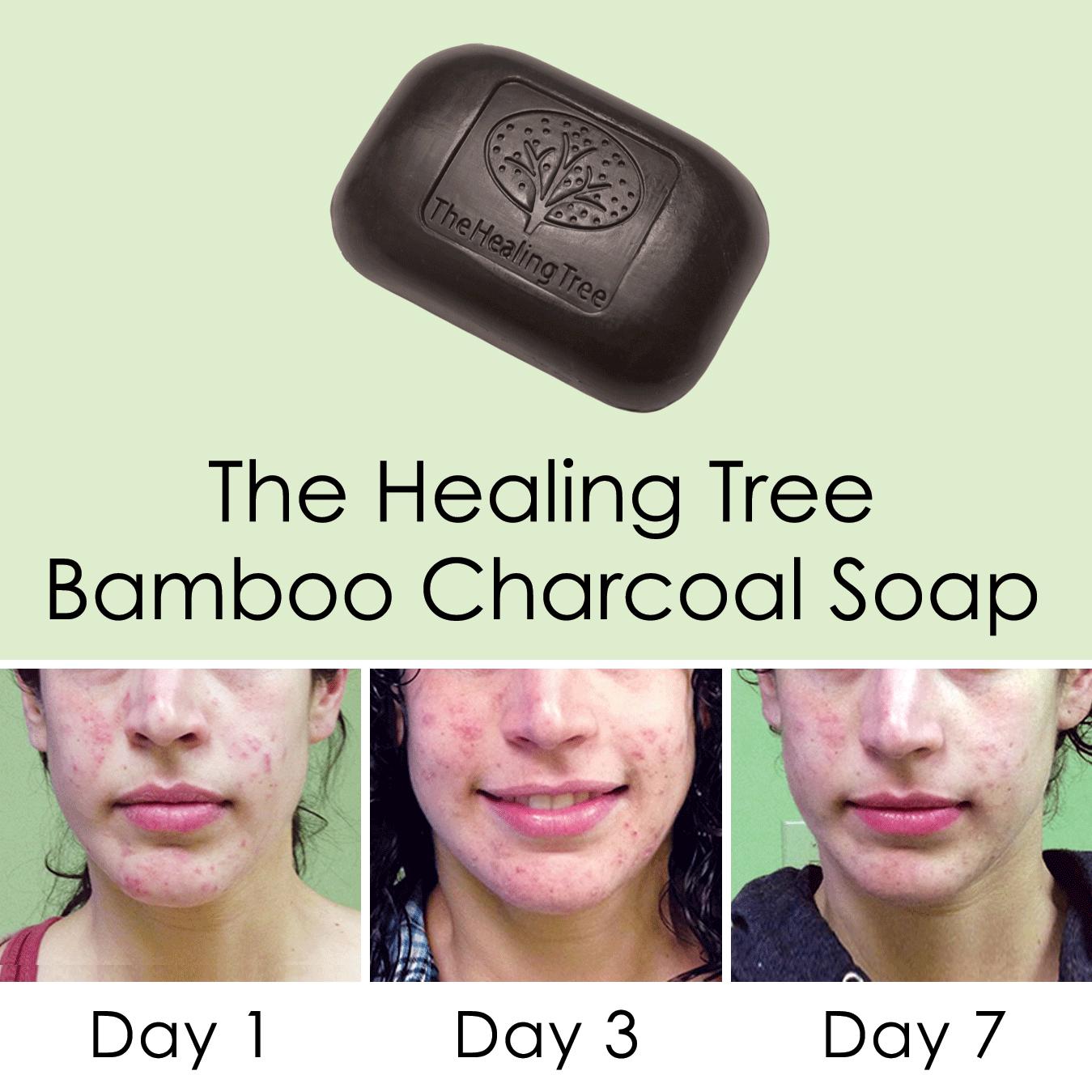 Bamboo Charcoal Soap for Acne Prone Skin - image 3