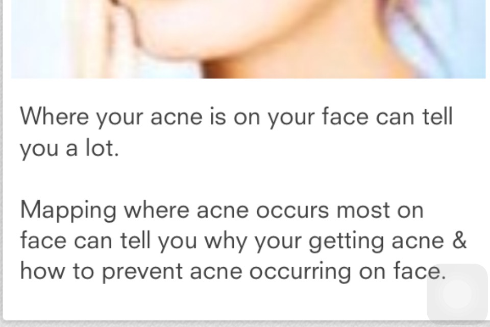 Face Mapping-What Your Acne Telling You? 😱👍👍