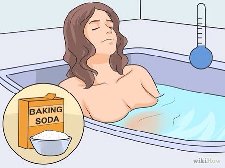 How To Get Rid Of Sunburn Overnight #greengoddess