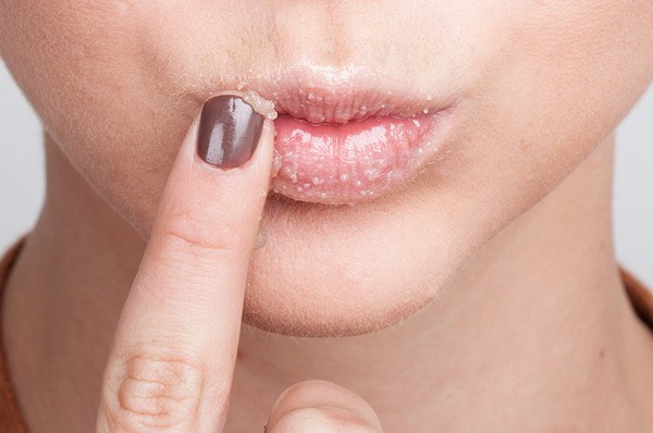 Use a lip scrub made with any type of sugar and then Rinse with warm water , your lips won't only be soft but they will be sweet 