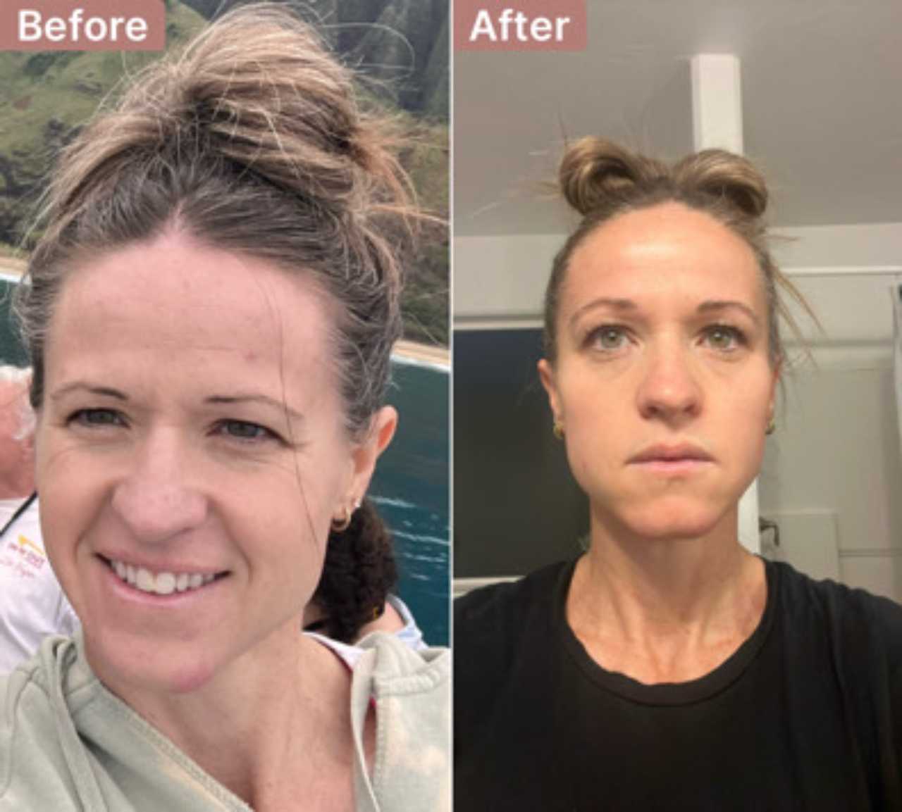 Anne J. -- before and after, 8 weeks