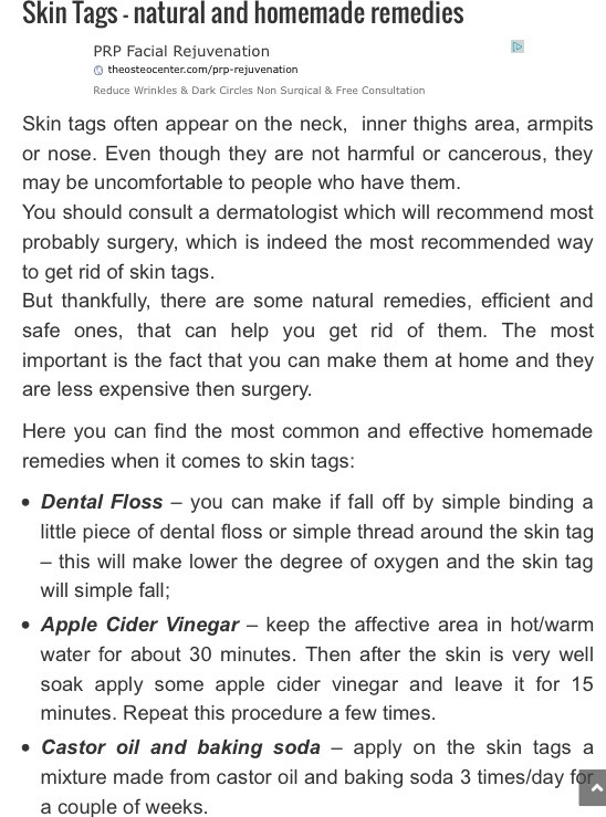 Health Remedies For Skin Tags!! 