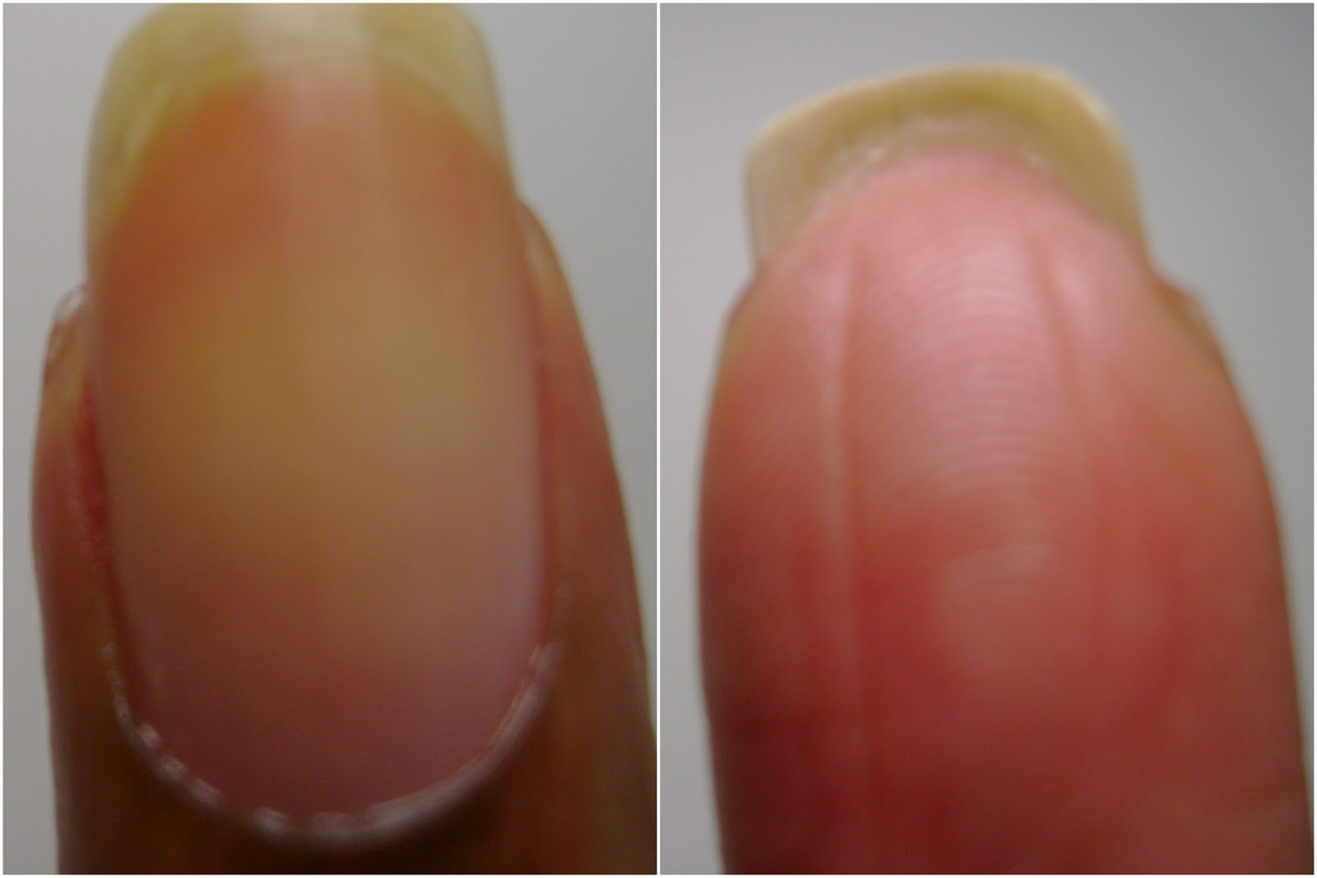 Grow Nails fast