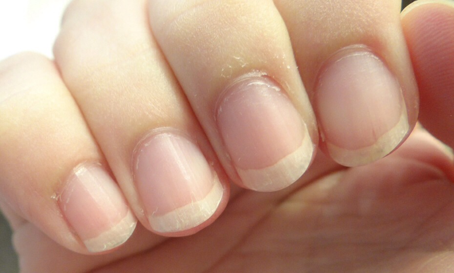 Cuticles: rub coconut oil, olive oil or Vaseline on them to promote healthy nails.