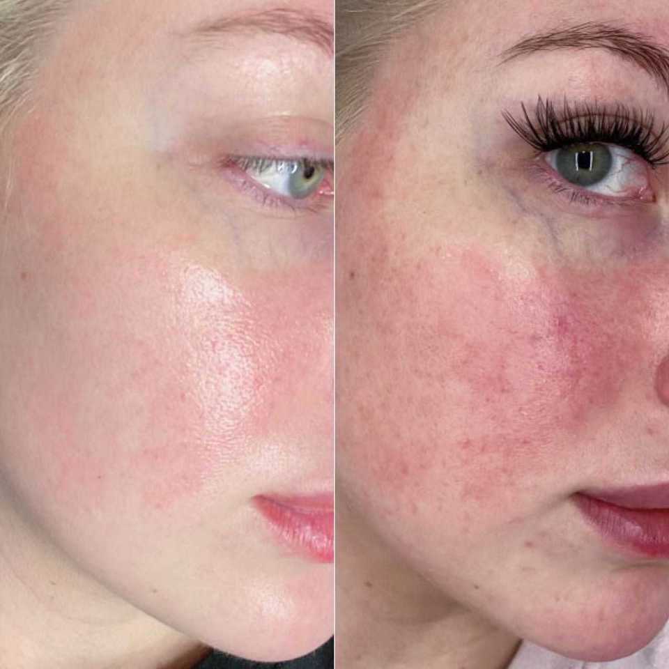 Customer photo