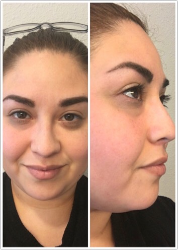 After only 4 uses I see a noticeable difference in my skin! My blemishes and redness have diminished greatly!  Over all I am extremely happy with this product. The mask is dry so you can make it as thin or thick as you'd like. 

A little goes a long way! 
