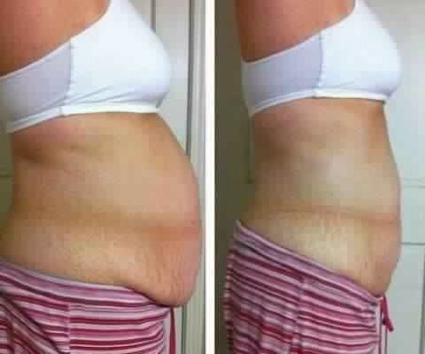 Get Distributor Prices On All Weight Loss Body Contouring Skinny Wraps 90 Day Challenge 