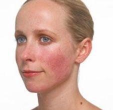 Cool your skin by sprinkling baby powder in your problem areas!