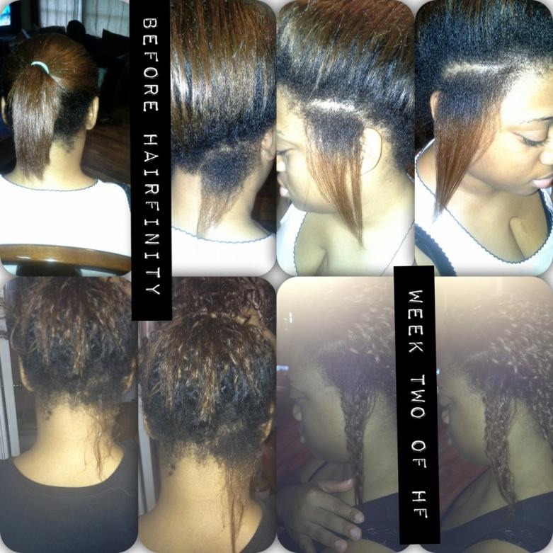 Hairfinity Works Wonders To Help Grow Hair Fast & Healthy 