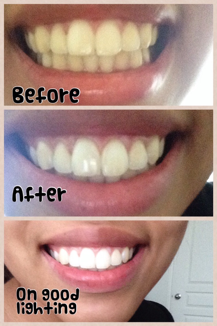 white Teeth In Seconds ( Tested By Me)