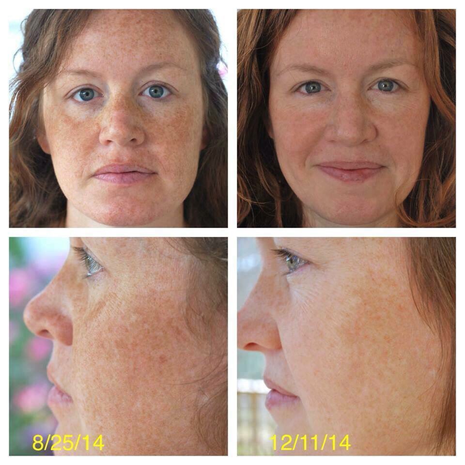 Glowing Skin 