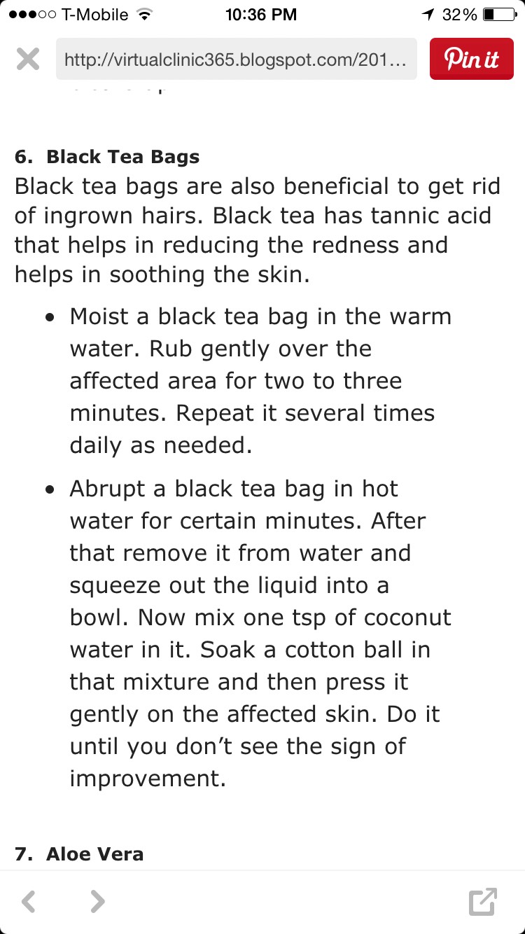 How To Get Rid Of Ingrown Hair! 