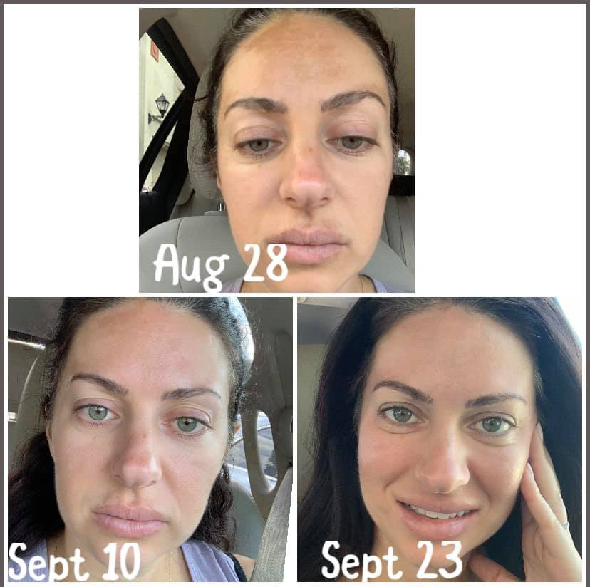 Customer photo