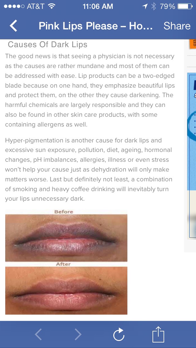 Pink Lips Please – How to Get Rid of Dark Lips Naturally

