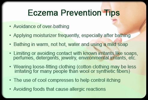7 Natural Remedies For Eczema