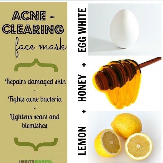 Natural Ways To Remove Acne Scars. 