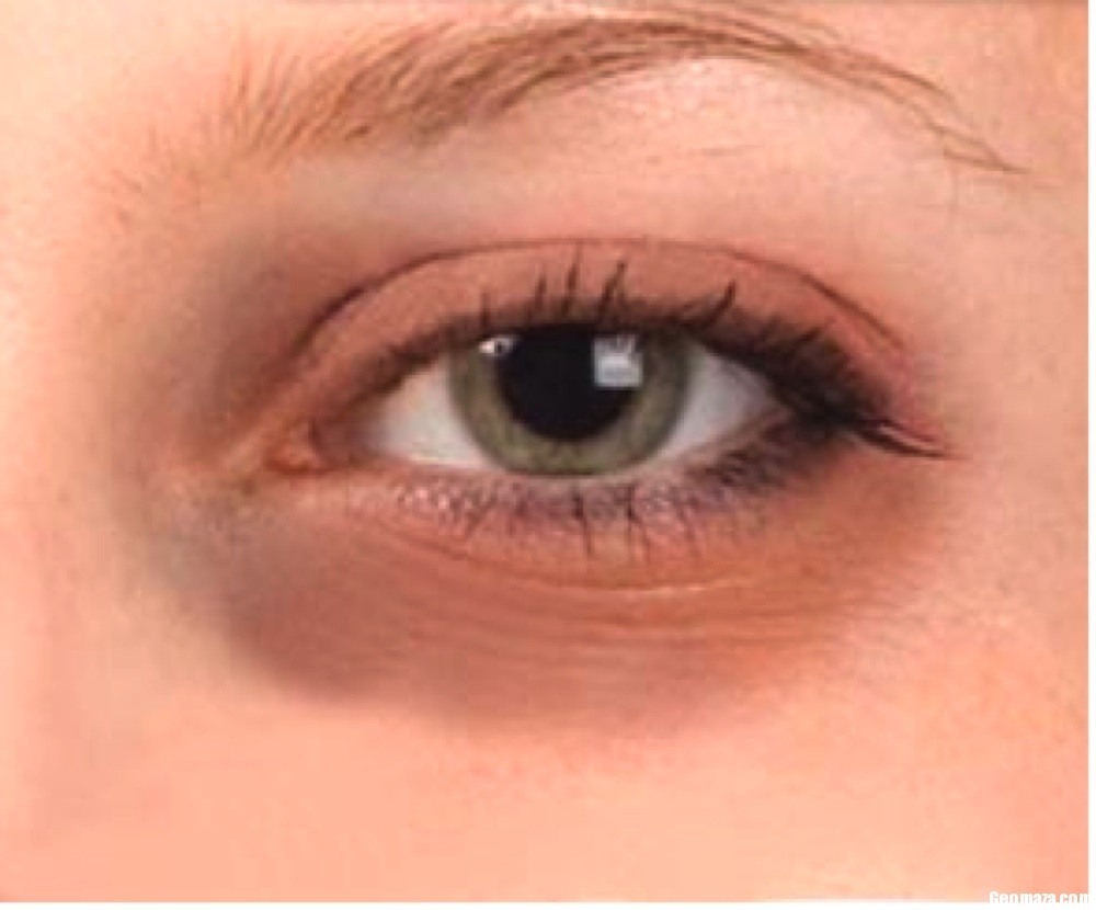 No more tired, puffy of dark eyes.