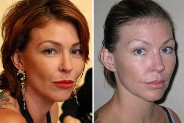 The face is made up of muscles so it makes sense to exercises to bulk-up and replace lost collagen due to age. Exercising also allows for more blood flow and oxygen which creates new skin collagen and elasticity.