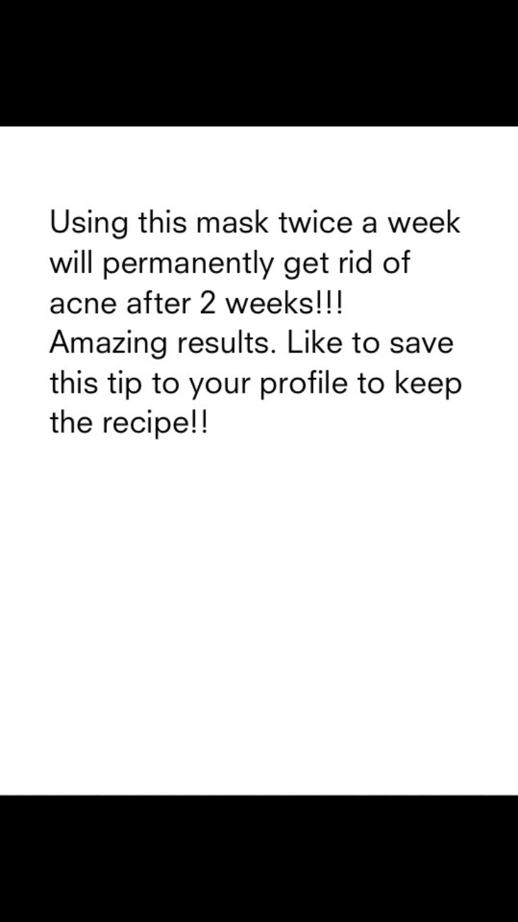 No More Acne 😆 Apple This Mask 2 Times A Week For 2 Weeks And The Acne Is Gone #tipit 😻😻