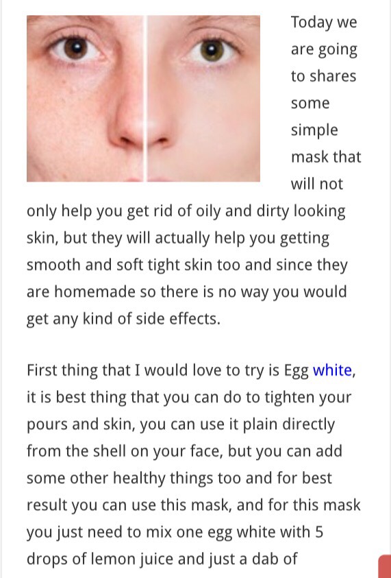 Get Rid Of Large Pores 