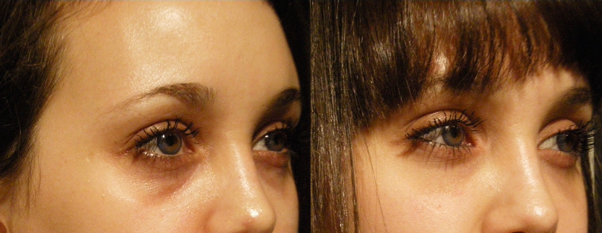 Dark Under eyes? Bags? Overnight Treatment ! 