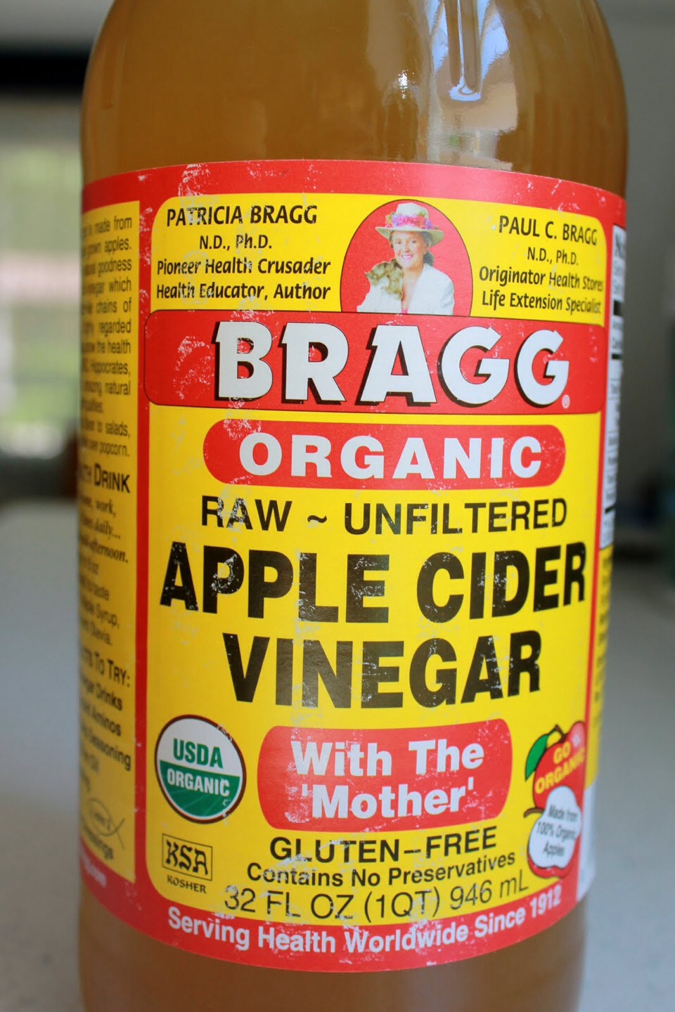 Apple cider vinager! Stop putting it on your face... Drink it instead! 
It's much to acidic to put on your skin. 
Drink 1 tbs daily regulates PH inside your body. I haven't had 1 cystic bump since I started doing this, even during my period. That's unusual for me!
Add it to hot green tea and honey.