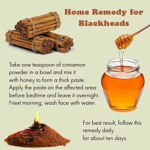 GET RID OF BLACKHEADS IN 3 MINUTES