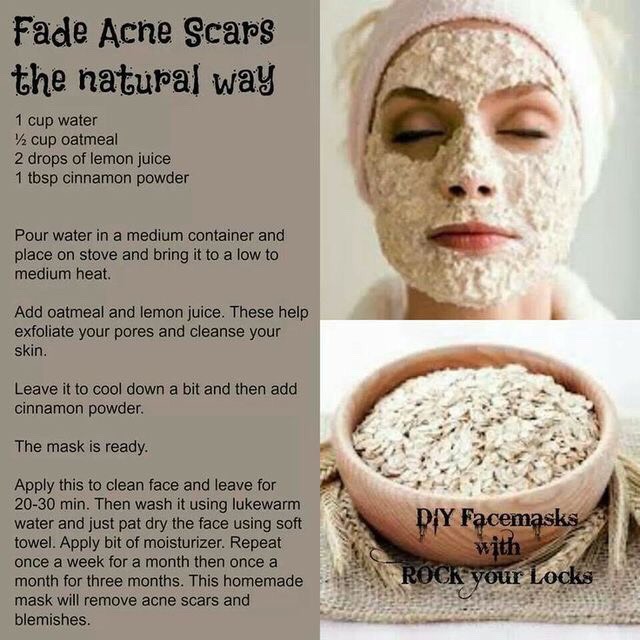 Yes this actually works .!
I have tried it and you should too..
This is the best for acne free skin😍❤️