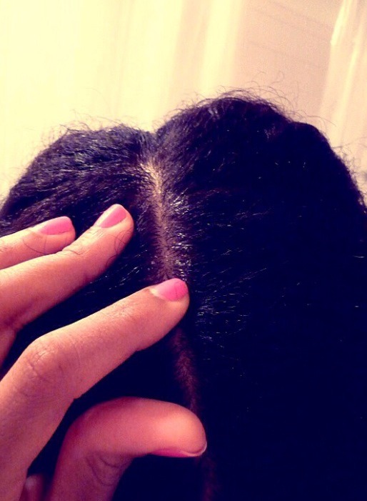 How To Grow Up Two-four Inches Of Hair In A Week!!!🎀💗