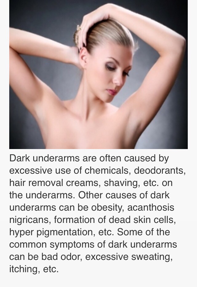 How To Get Rid Of Dark Armpits❗️