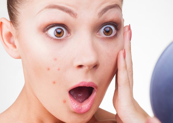 If you want to get rid of spots apply toothpaste to area before you sleep it should work overnight. The toothpaste should be plain white. This is a good alternative if you don't have a spot treatment.