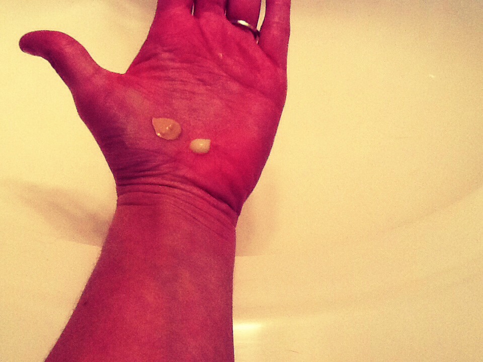 Dry Skin 