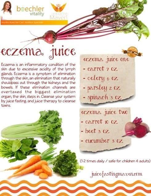 7 Natural Remedies For Eczema