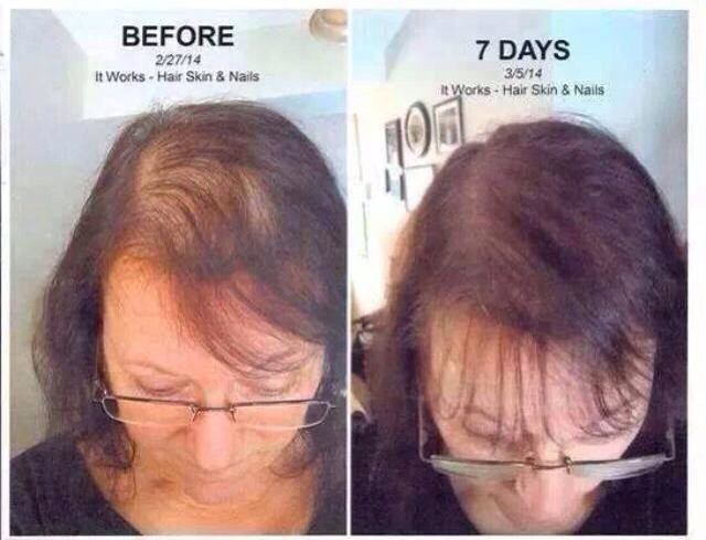 Easy Way To Grow Hair Back Fast