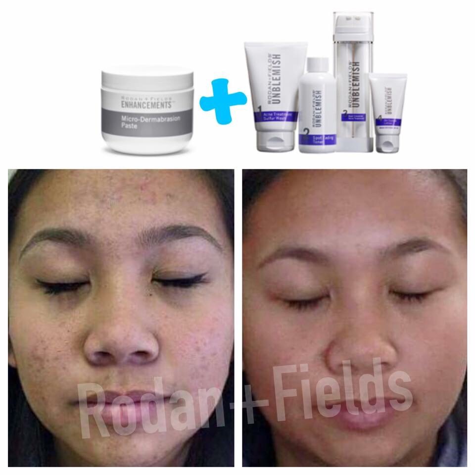 Glowing Skin 