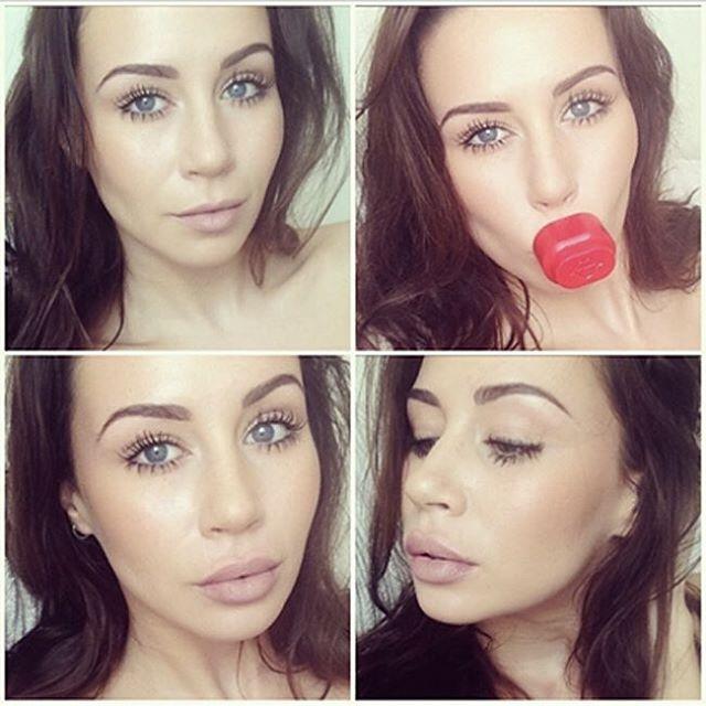Fullips makes the perfect alternative to lip enhancers! The Fullips enhancer keeps delicate lips safe from irritating plumpers, or invasive injections.