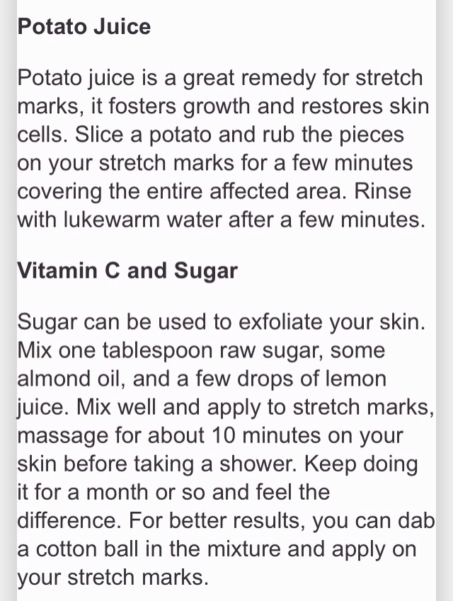 Home Remedies for Stretch Marks 😍