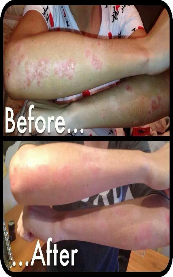 lose weight, tone up, clear skin, boost energy all in one product!!