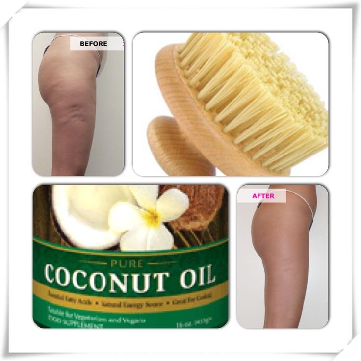 17. When used consistently on skin it can help get rid of cellulite.