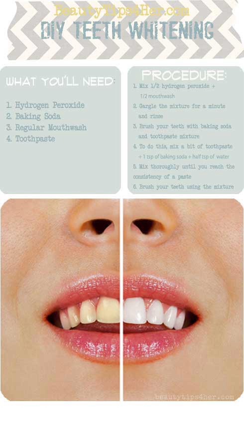 The good news is, this simple remedy work without the need of going overboard while cutting down the cost of buying teeth whiteners.