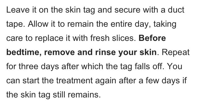 Home Remedies To Remove Skin  Tags 