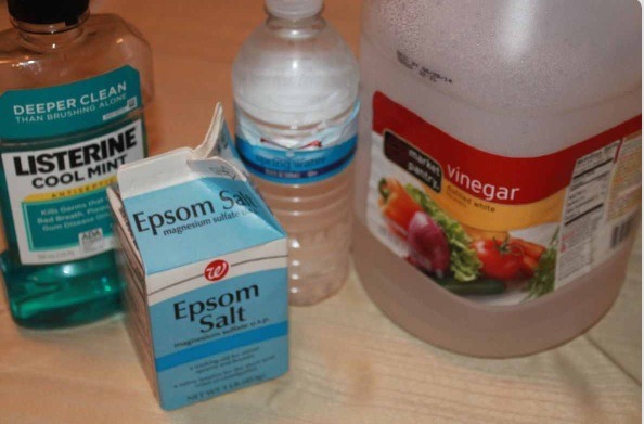 💥 1 cup of water
💥 1/2 cup of Listerine mouth wash
💥 1/4 cup of vinegar
💥 1/4 cup of Epsom Salt

🎉Bonus Tip🎉 SCRUB FEET WITH EPSOM SALT WHILE THEY'RE SOAKING TO GET RID OF EXCESS DEAD SKIN!!!
