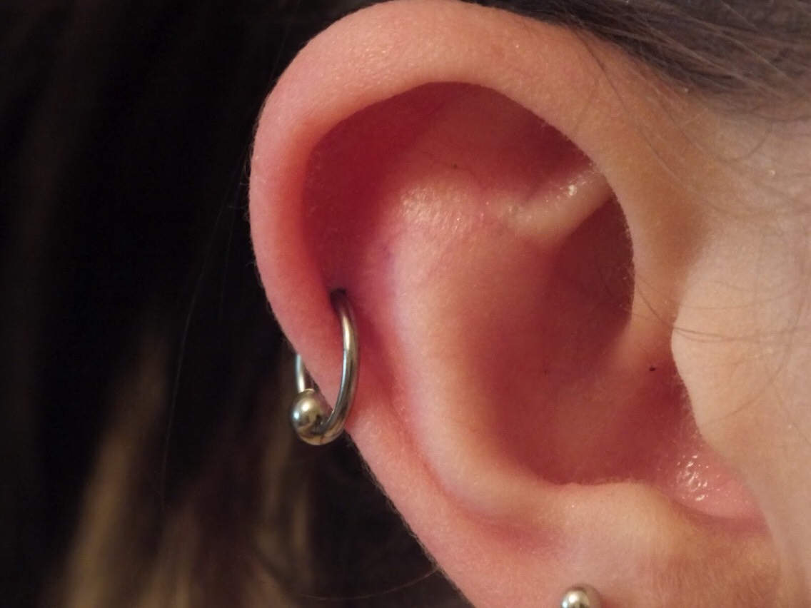 Helix. 