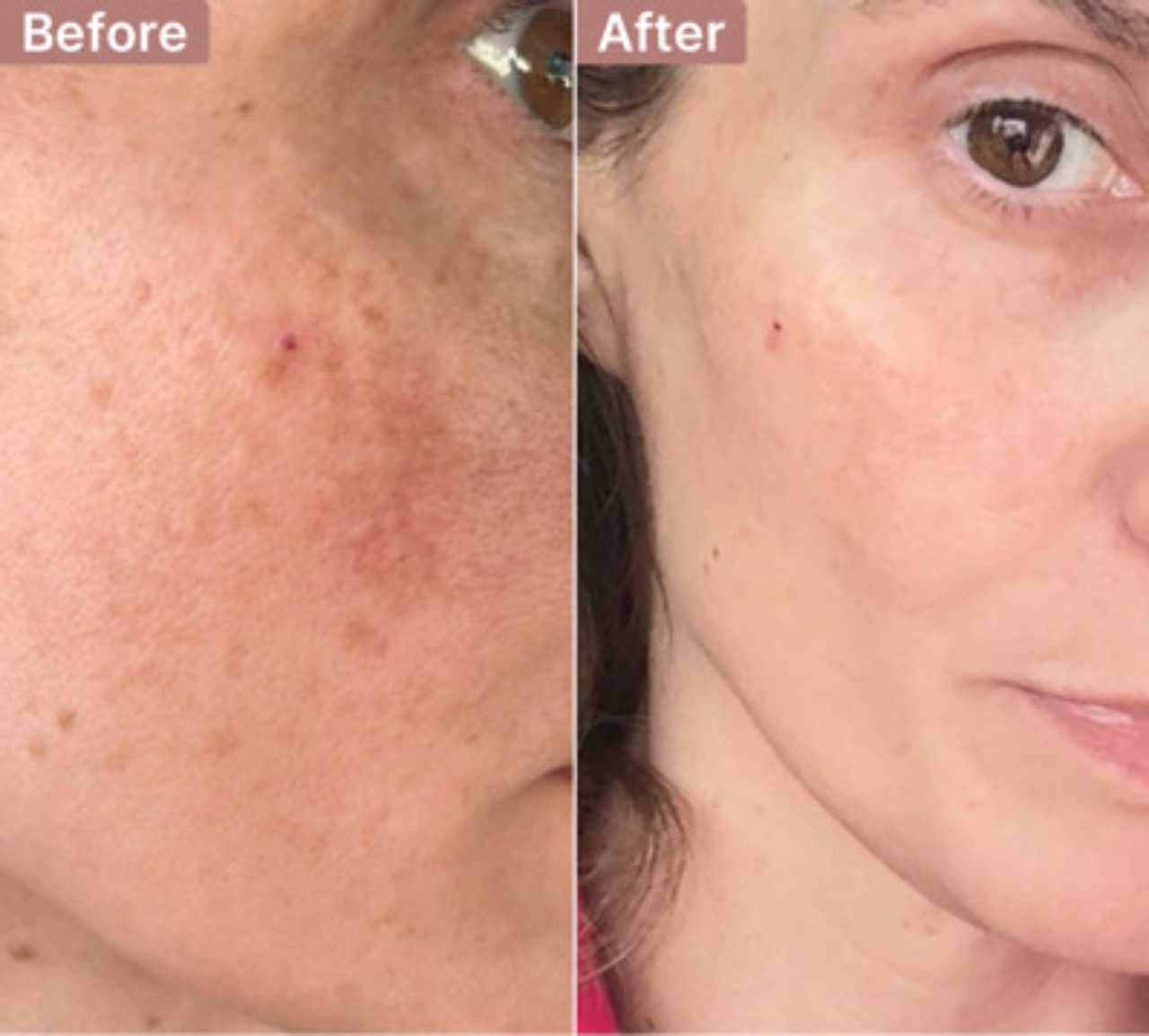 Destiny -- before and after, 8 weeks