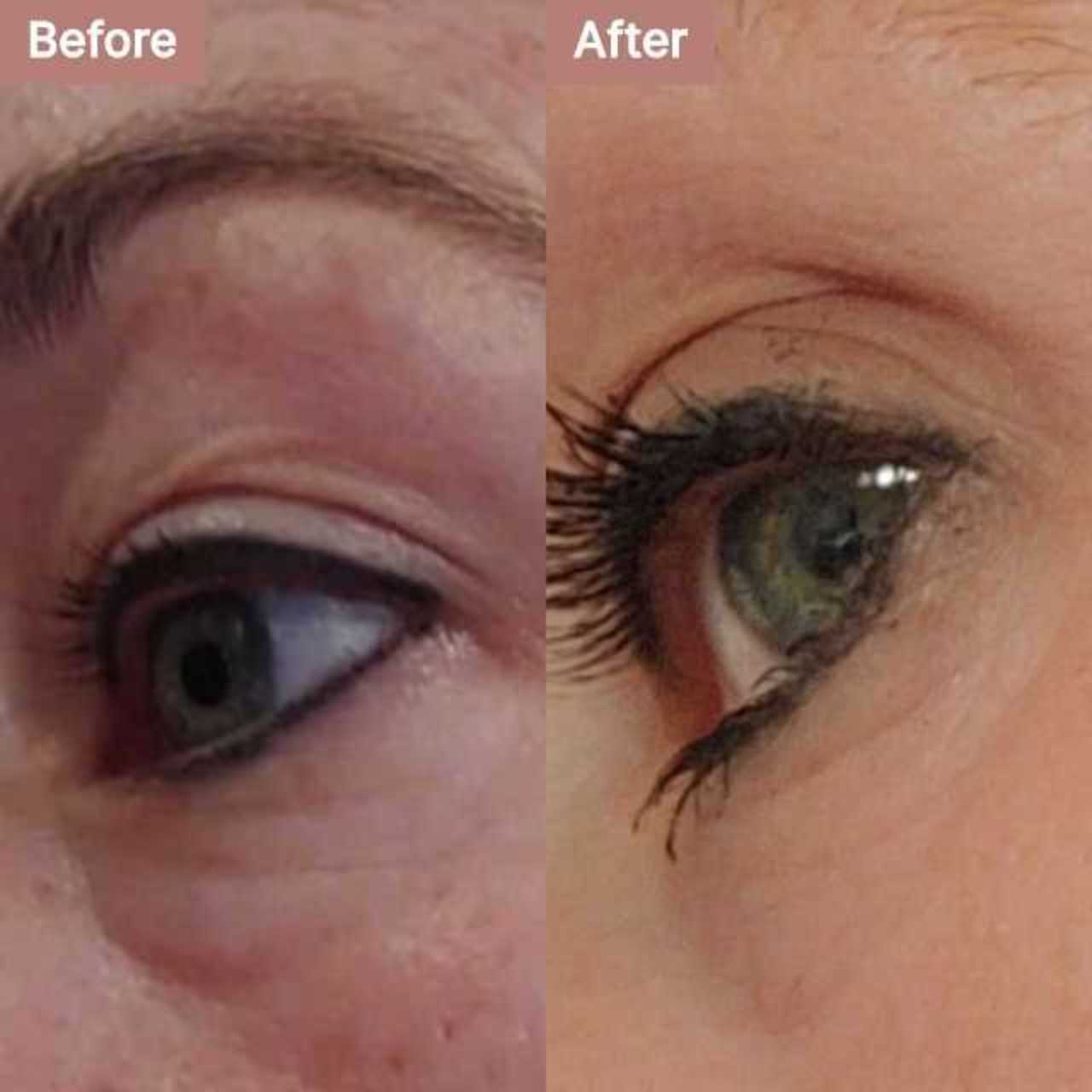 user-55-31389 -- before and after, 8 weeks