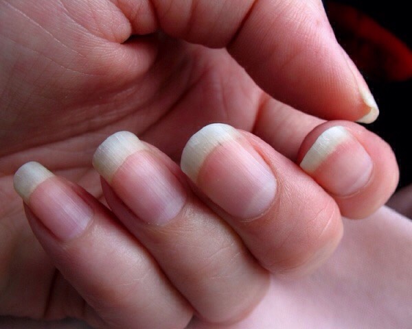 Chop the onions into little pieces and pout them inside the clear nail polish and it will make a nail growth it's as simple as that