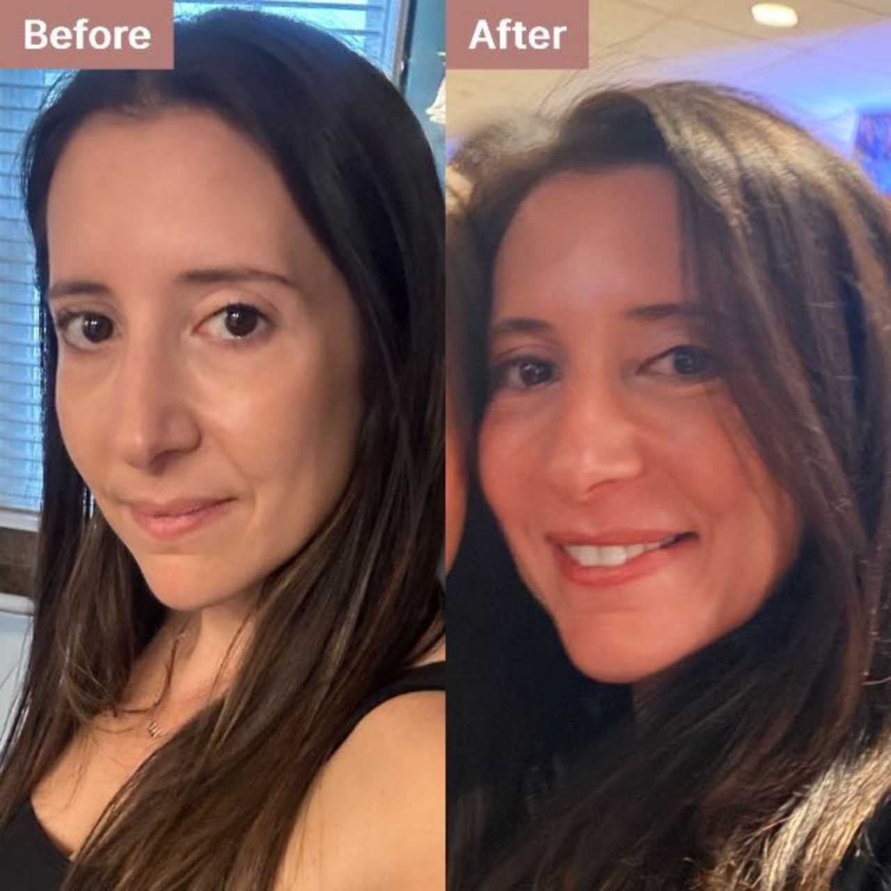 user-30-27532 -- before and after, 8 weeks