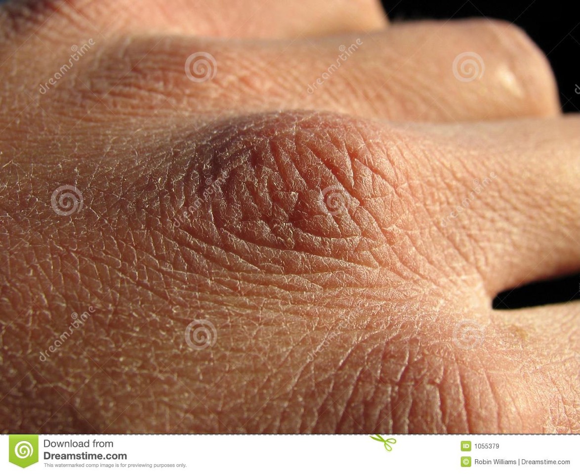 2. Got dry skin? Just rub over affected areas every night and soon, the dryness will be gone!