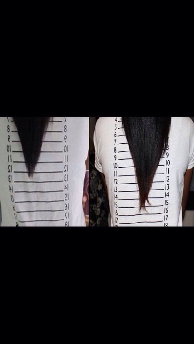 How To Grow Your Hair 1-4 Inches Of Hair In A Week!😘