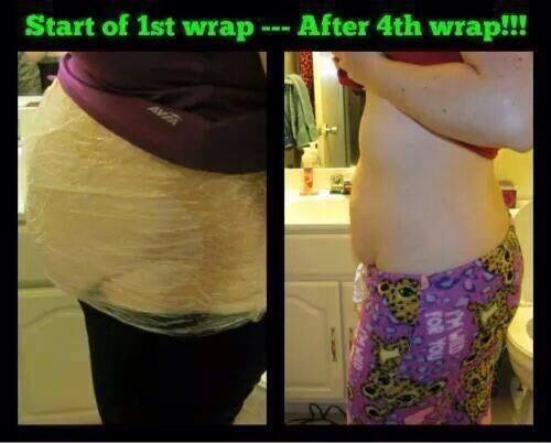 The Before-and-After pictures are amazing!